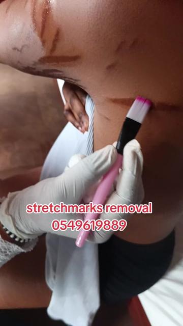 @Dr.nao1