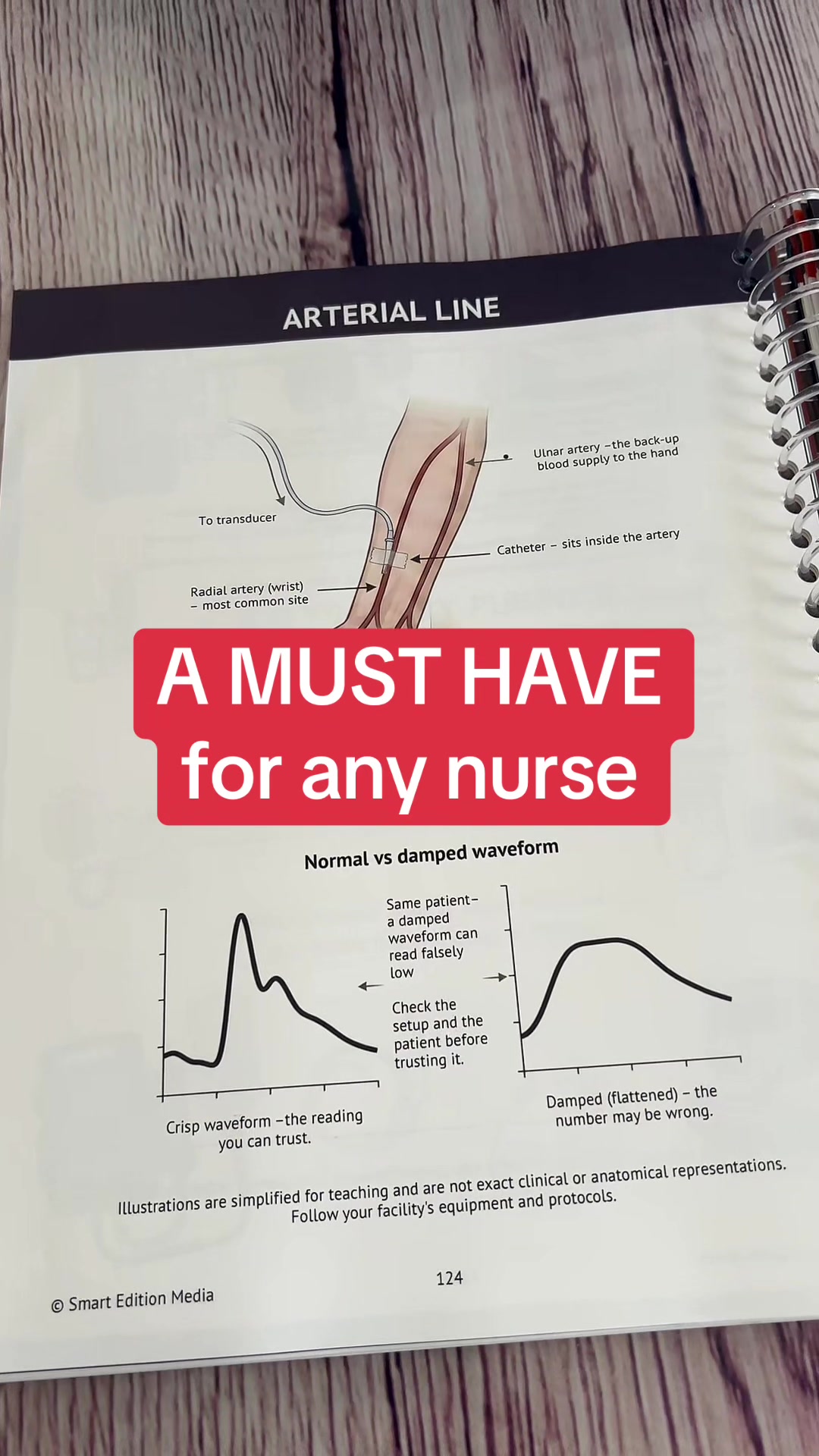 @Smart Edition Nursing