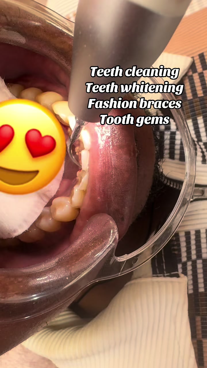 @Teethwhitening—MartGlow Avenue