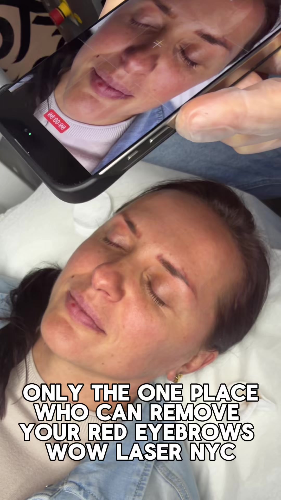 @Safe Eyebrows Tattoo Removal🗽