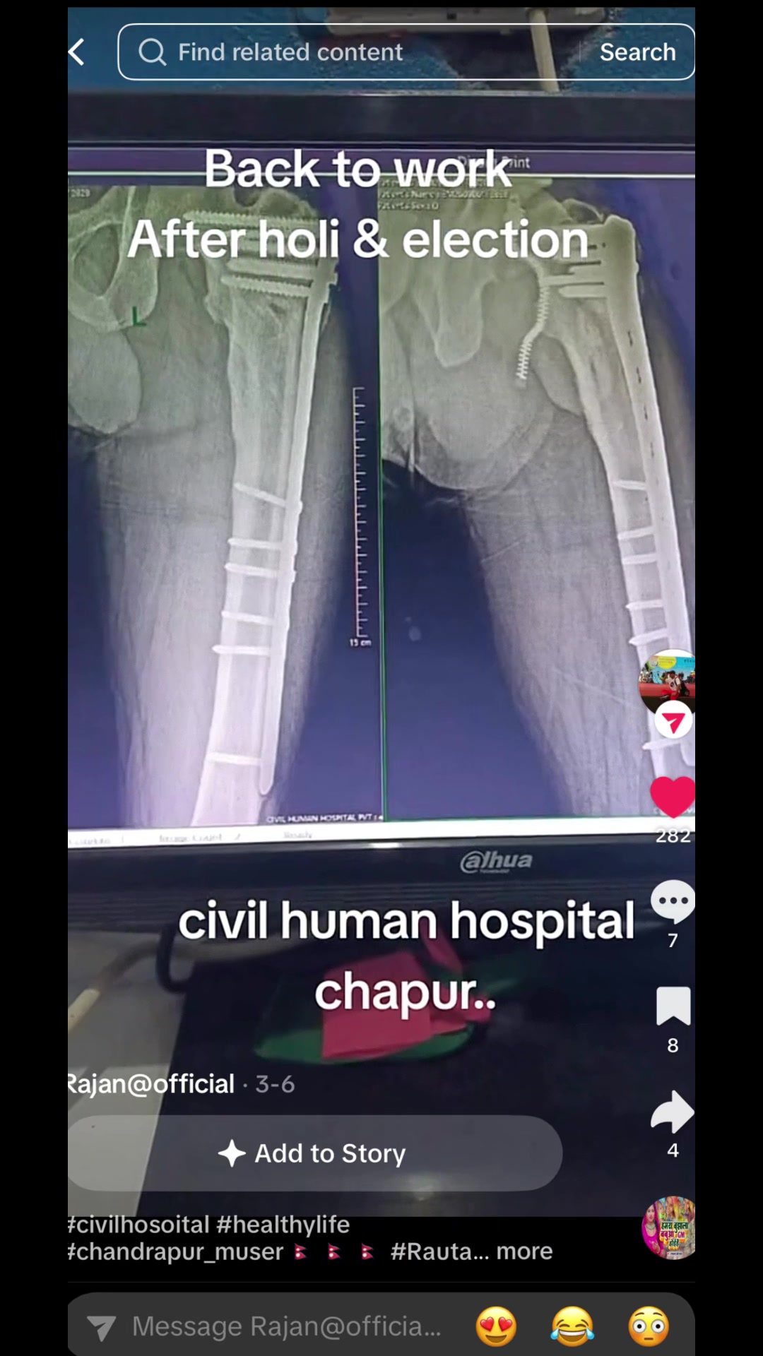 @Civil Human Hospital