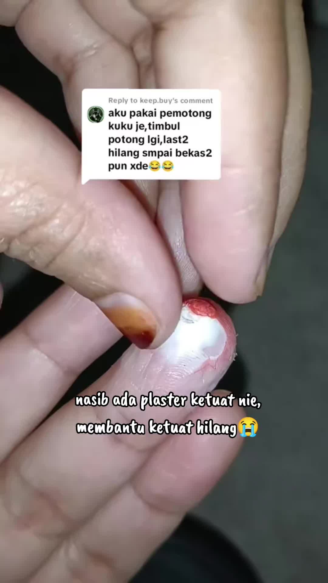 @Umieww
