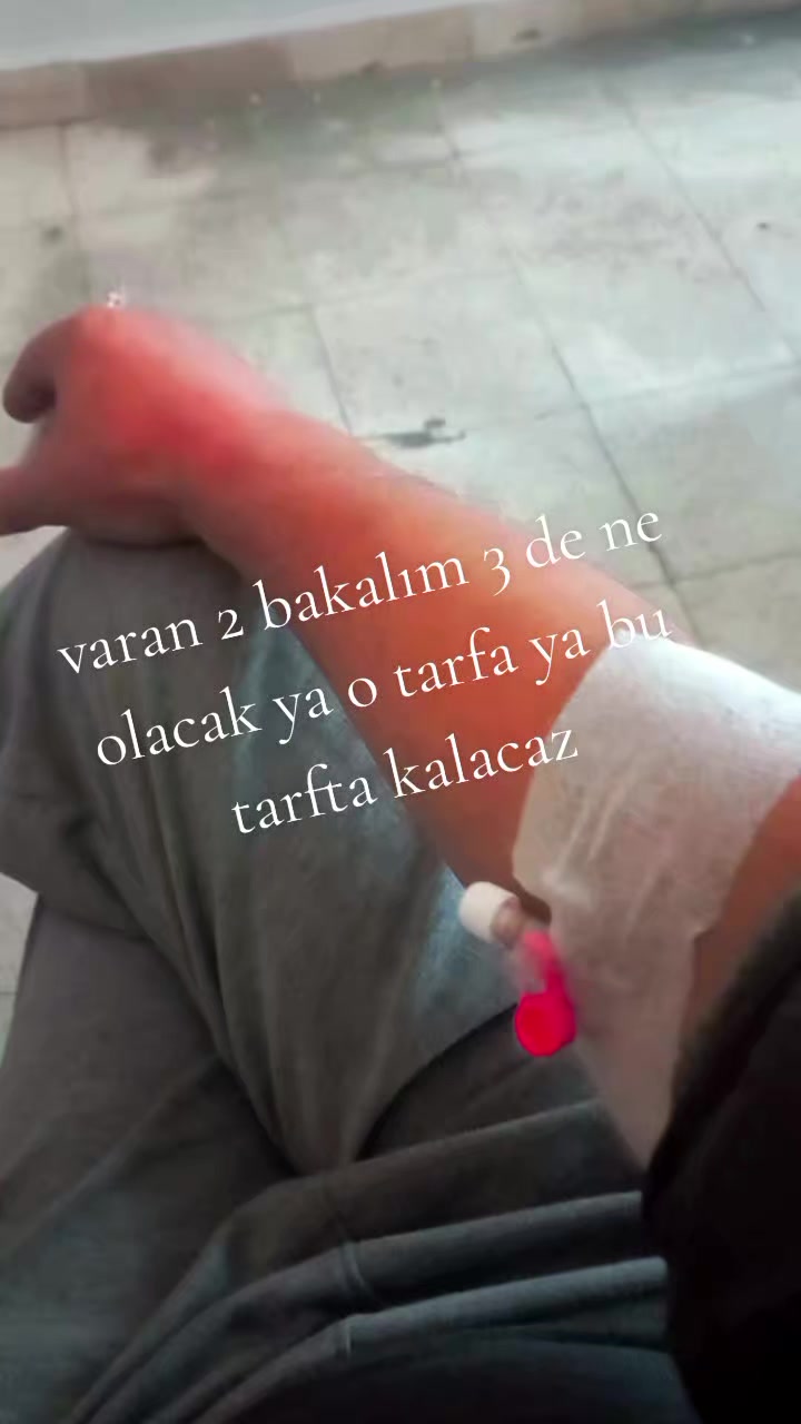 @Yığılca lı memedim.