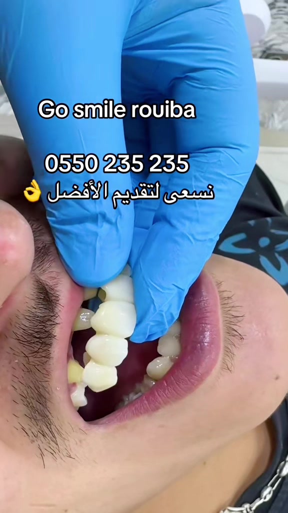 @GOSMILE ROUIBA🇩🇿