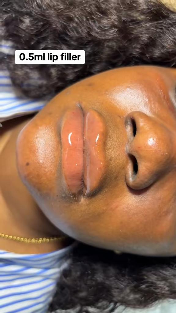 @LOZIK AESTHETICS | SPA IN AJAH