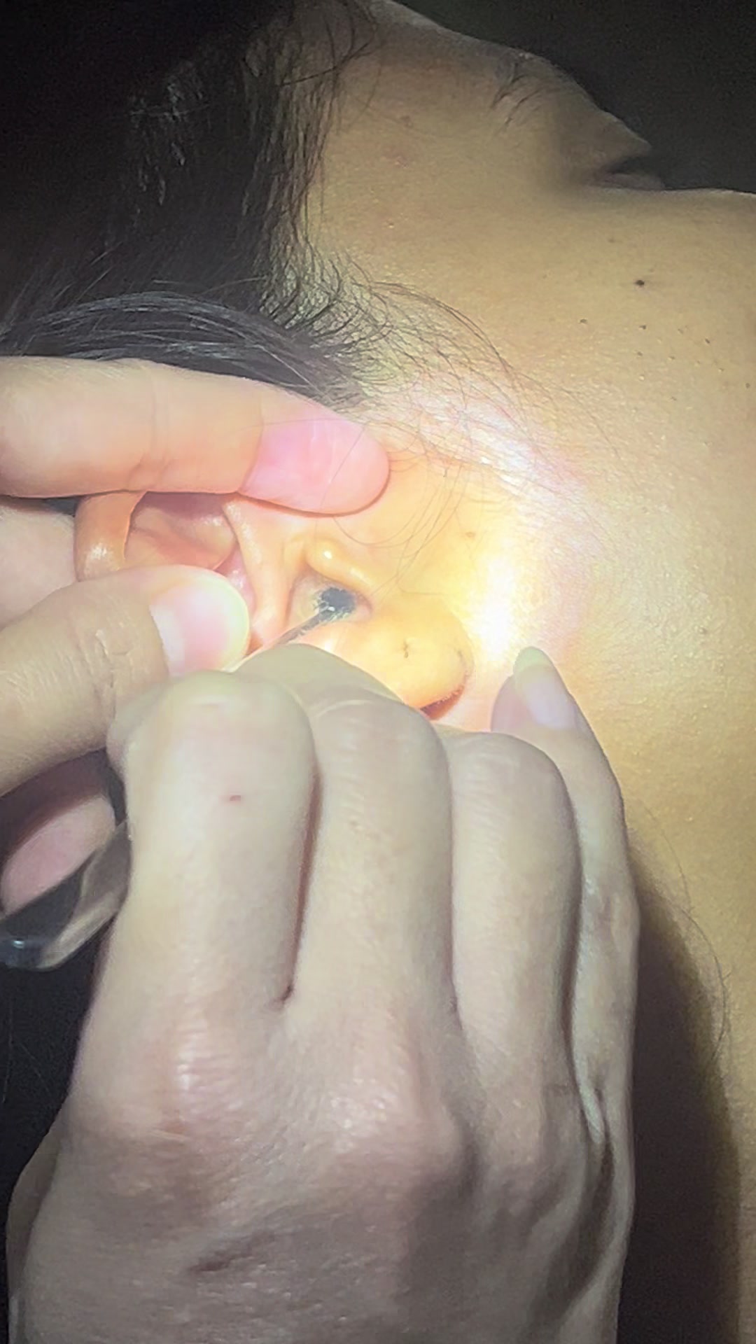 @ហាង សំអាតត្រចៀក 081 674455