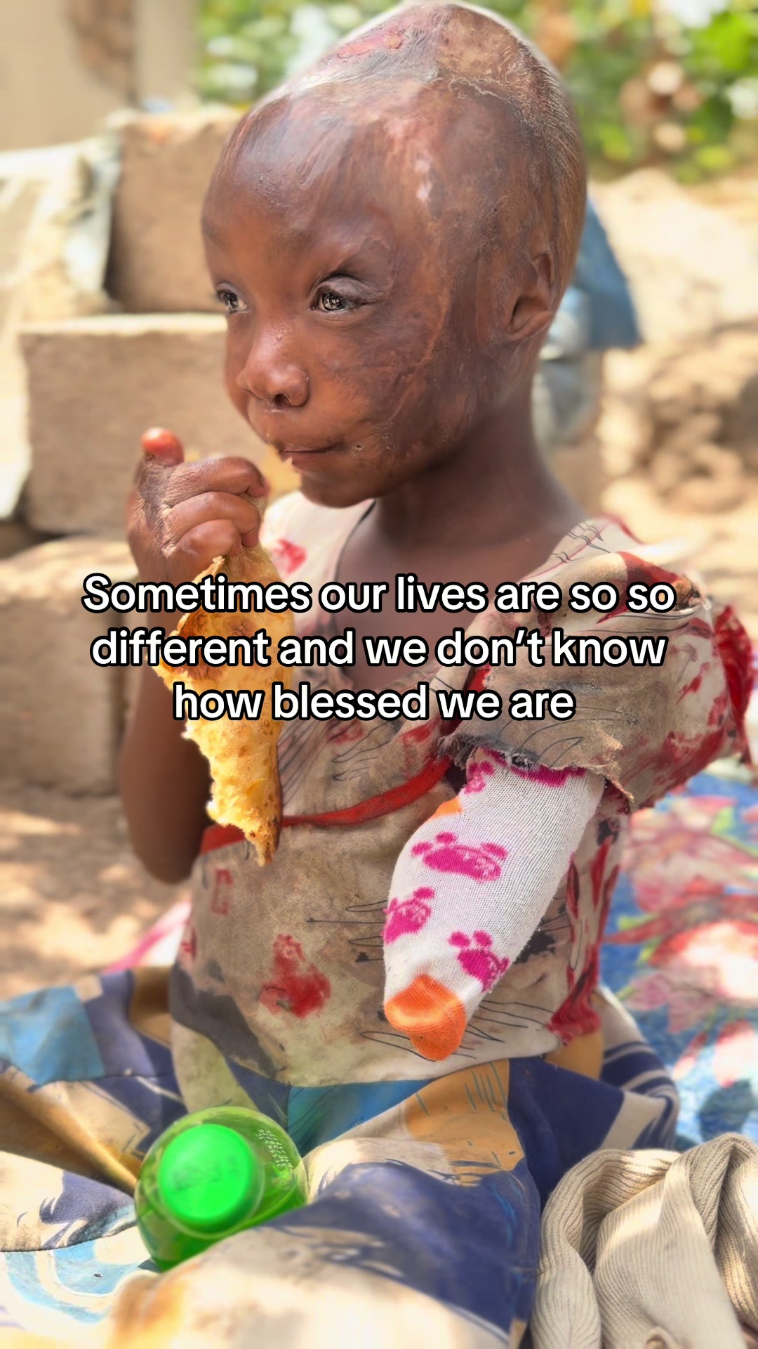 @Matayo Ssentongo