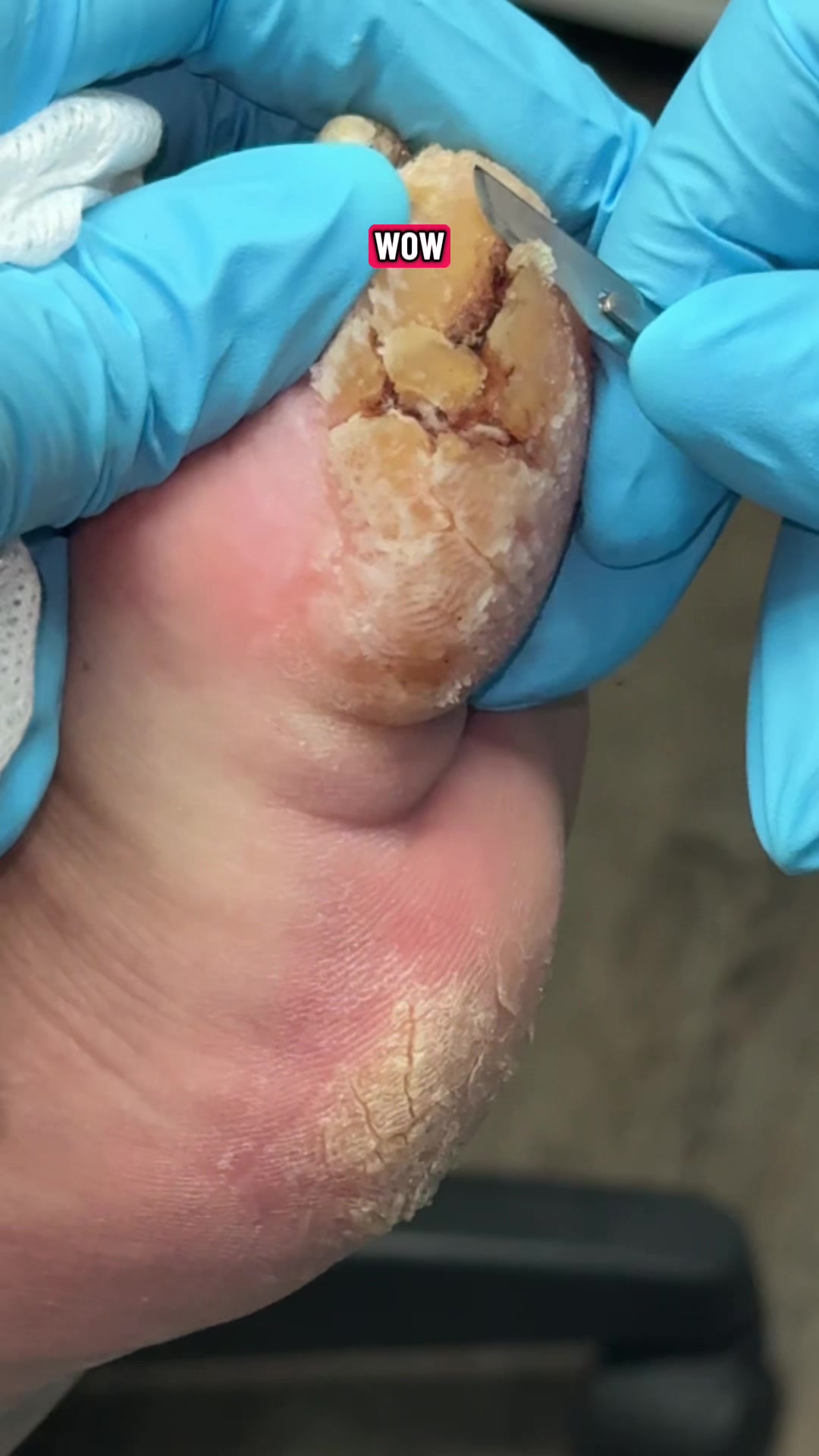 @Deniel Foot and Ankle Center