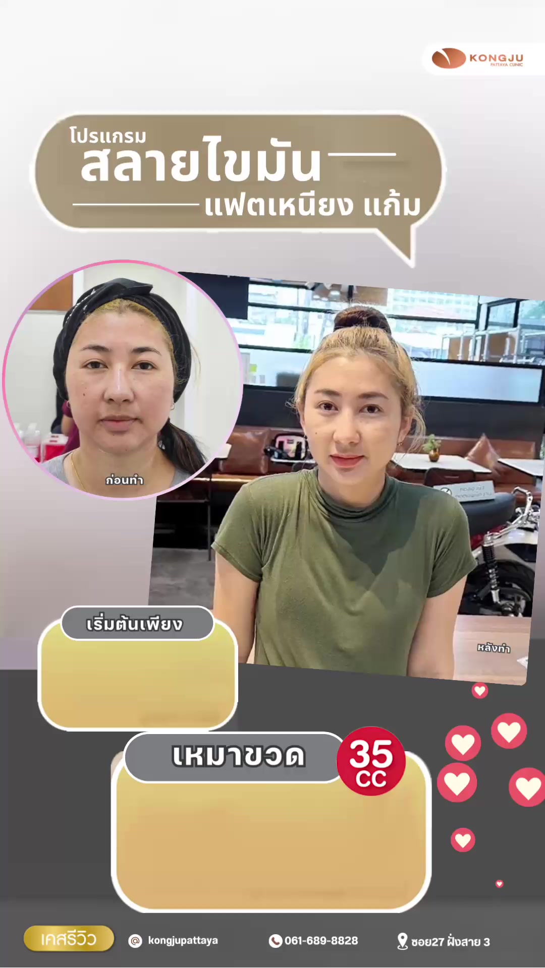 @กองจู พัทยา