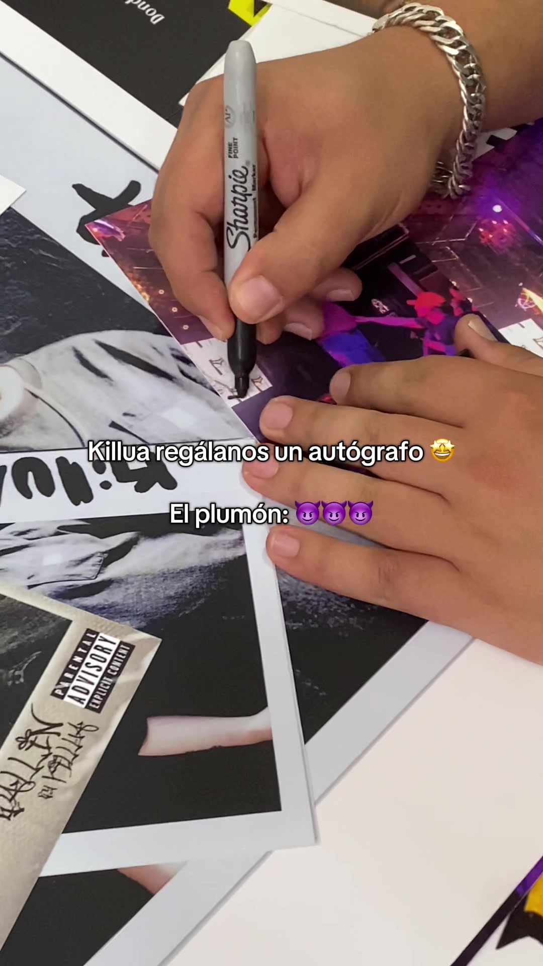 @Estudio Aleatorio