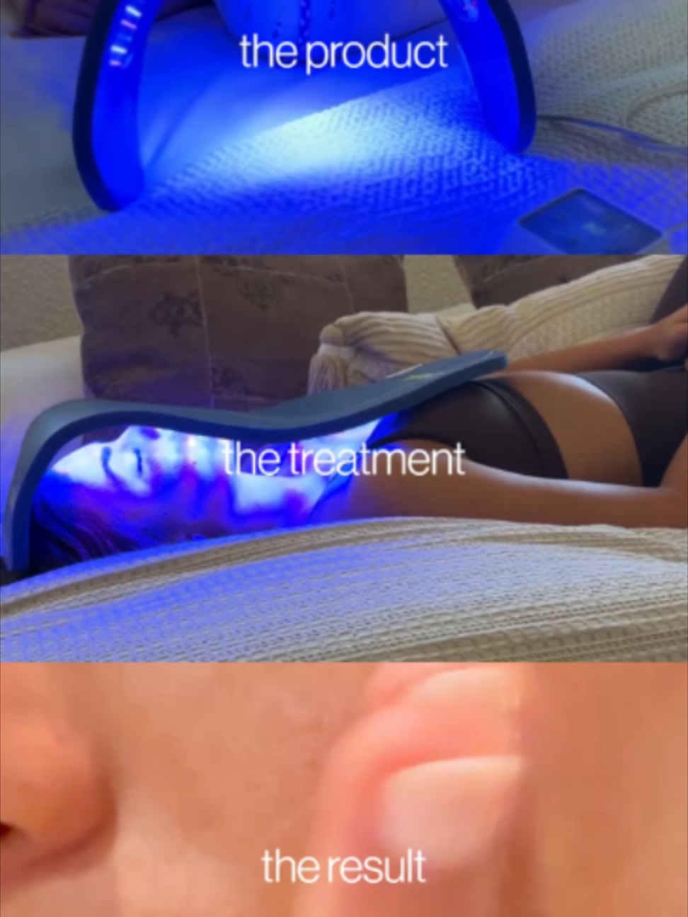 @Celluma Light Therapy