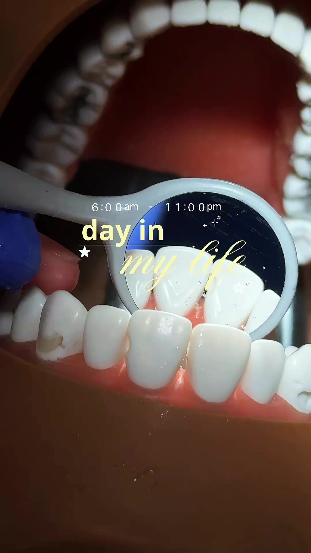@simone | D2🦷