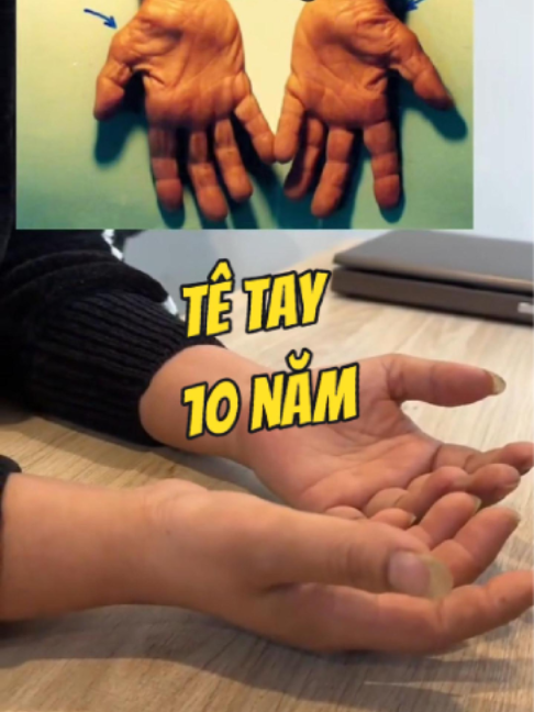 @Chuy&ecirc;n gia xương khớp