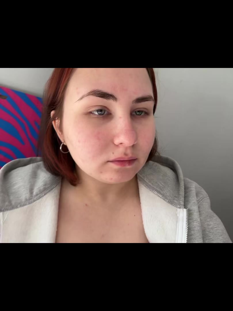 @азаличка