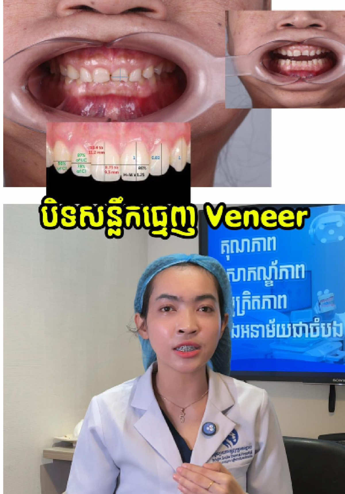 @BRIGHT SMILE DENTAL HOSPITAL