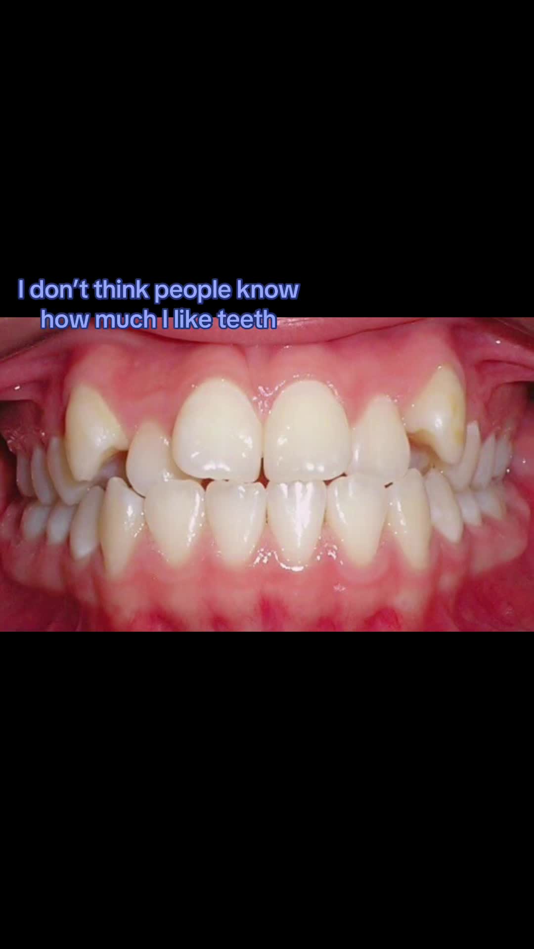 @teeetharecool