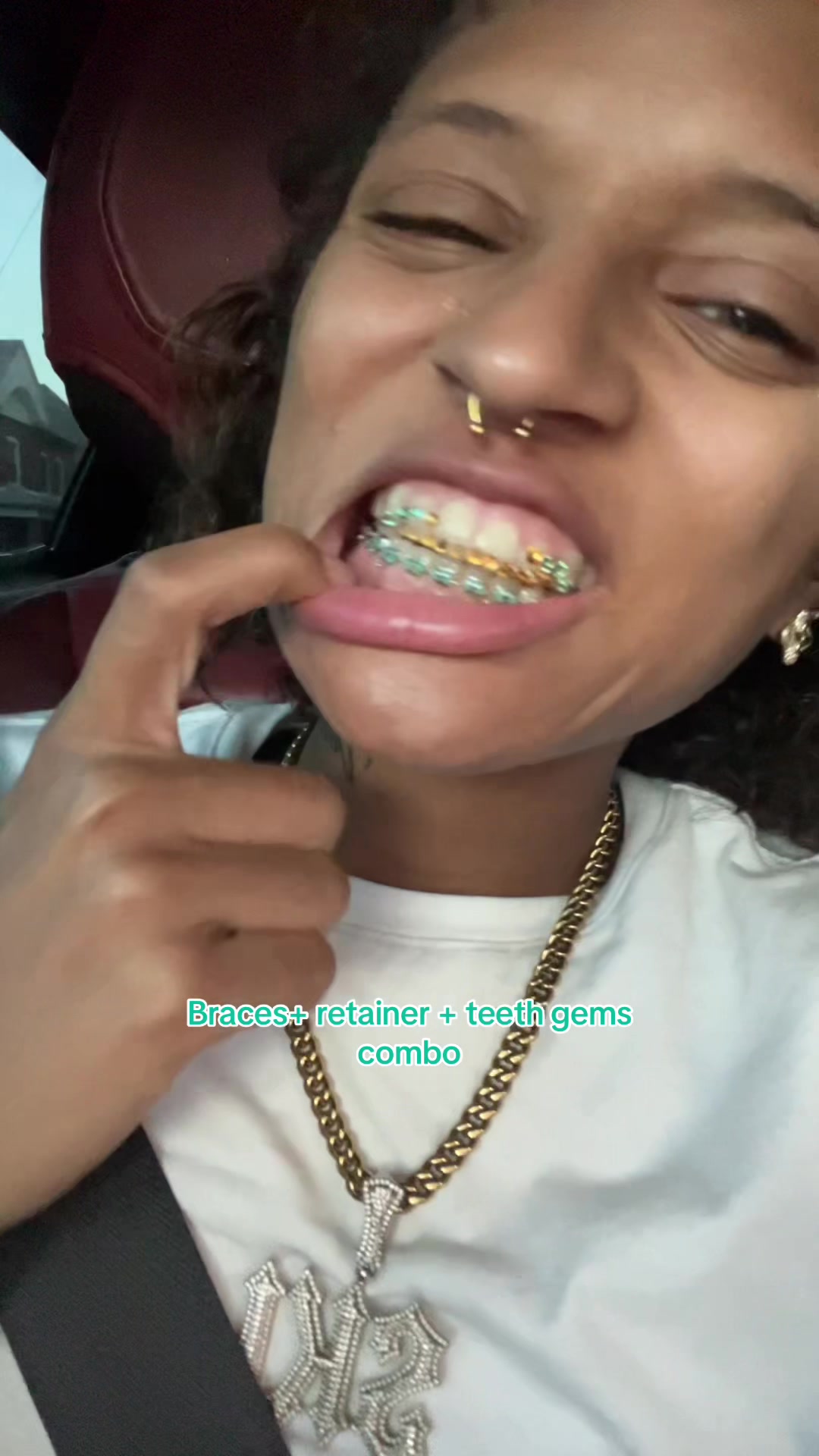 @indigo$ki