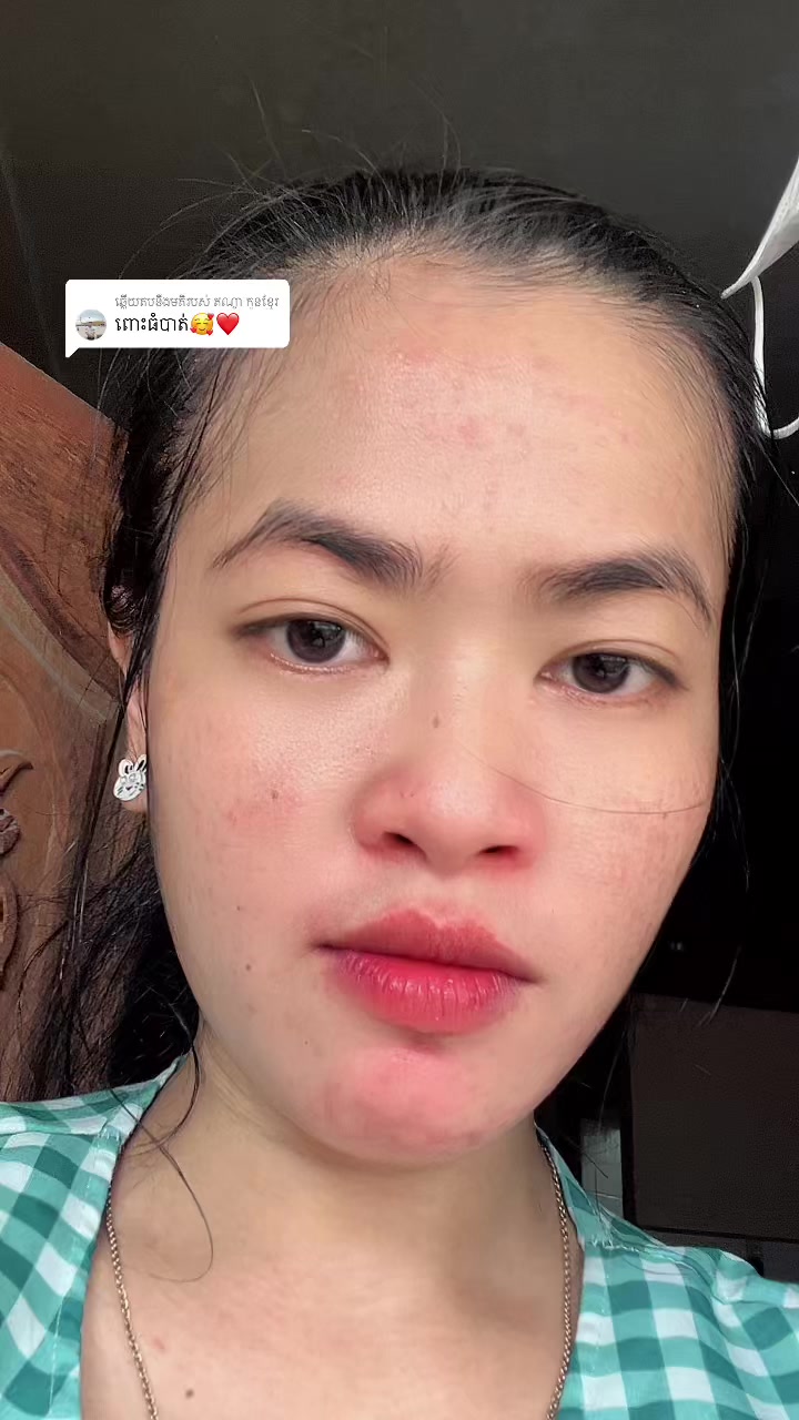 @លីណែត♥️😘🖐️