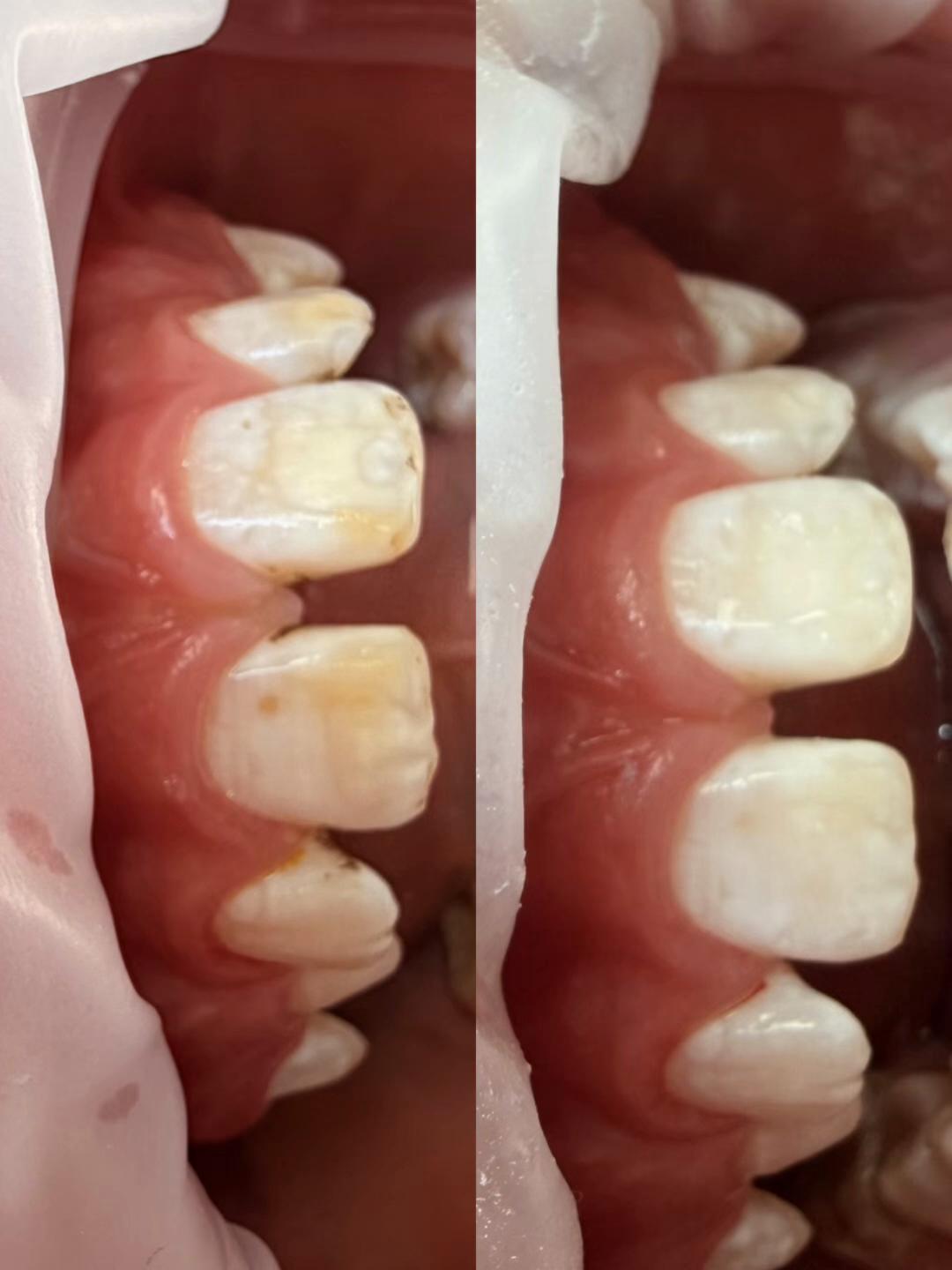 @Stomatolog Snejana Carabulea🦷