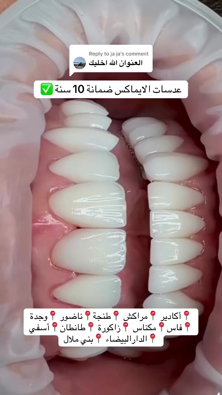 @brightsmileee1