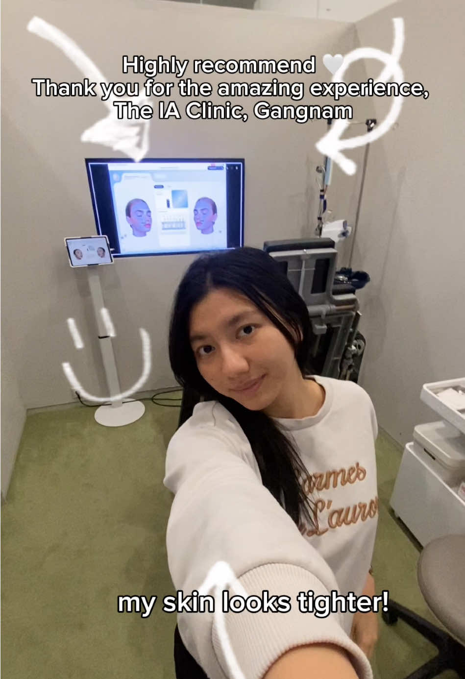 @Irena Gunawan