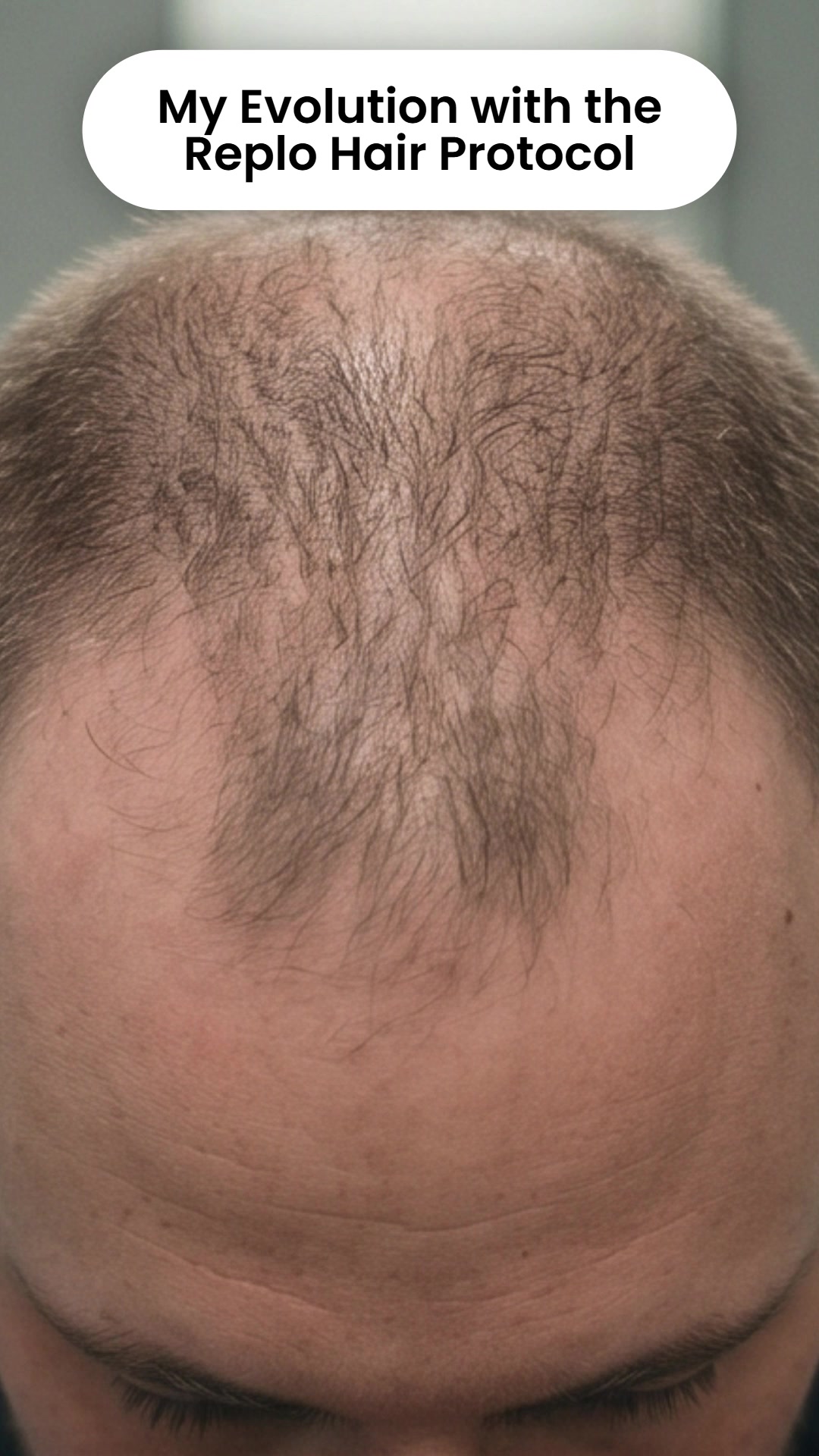 @Replo Hair Clinic