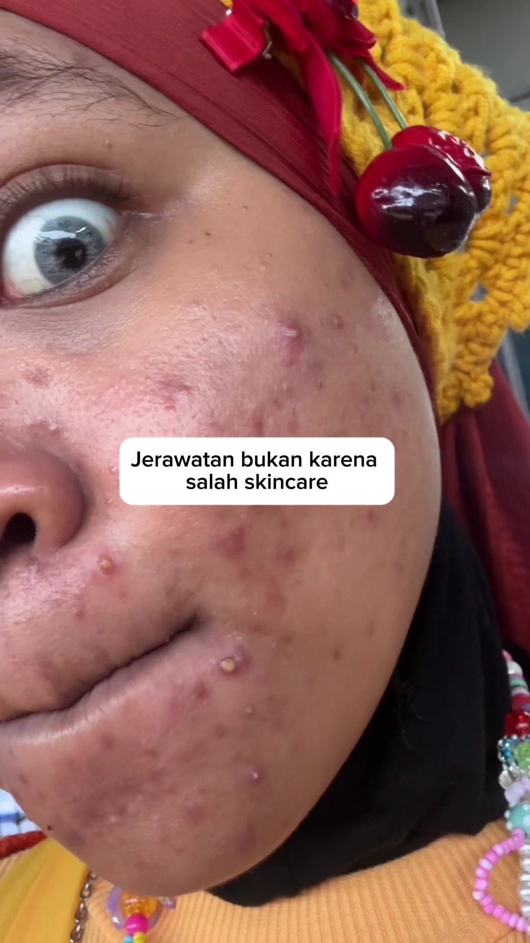 @MBAK CUNGCAT BAYI