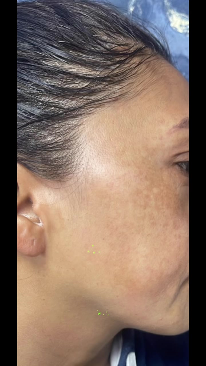 @Dra Silvia Lorena FLORES derma