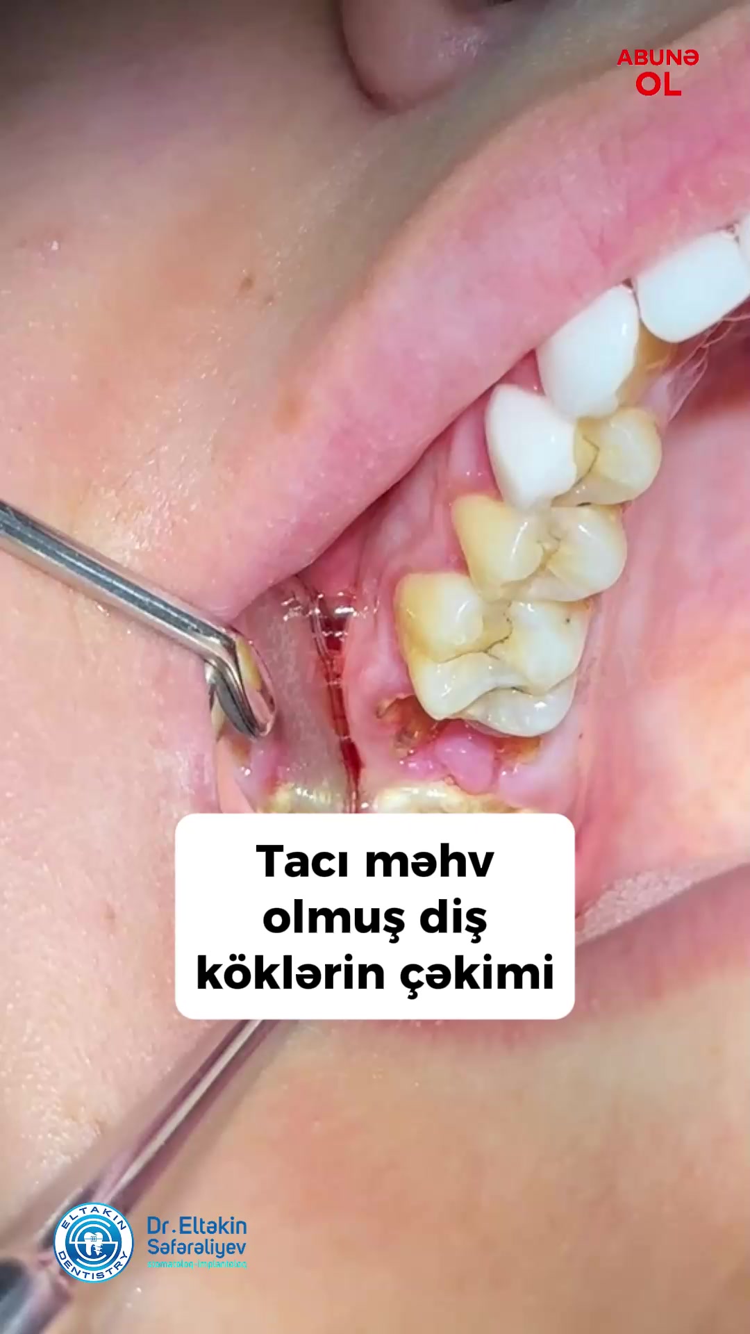@eltakindentistry
