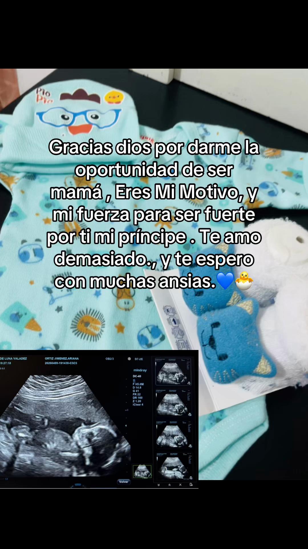 @Arii Jimenez