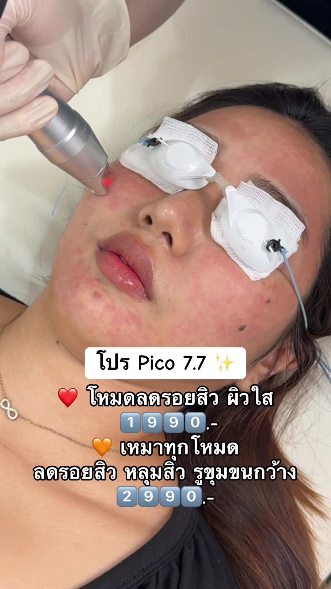 @APEXYOUNGCLINIC