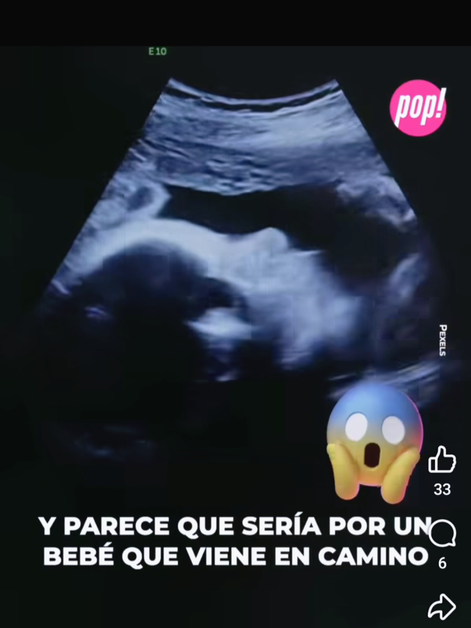 @variedades 22A