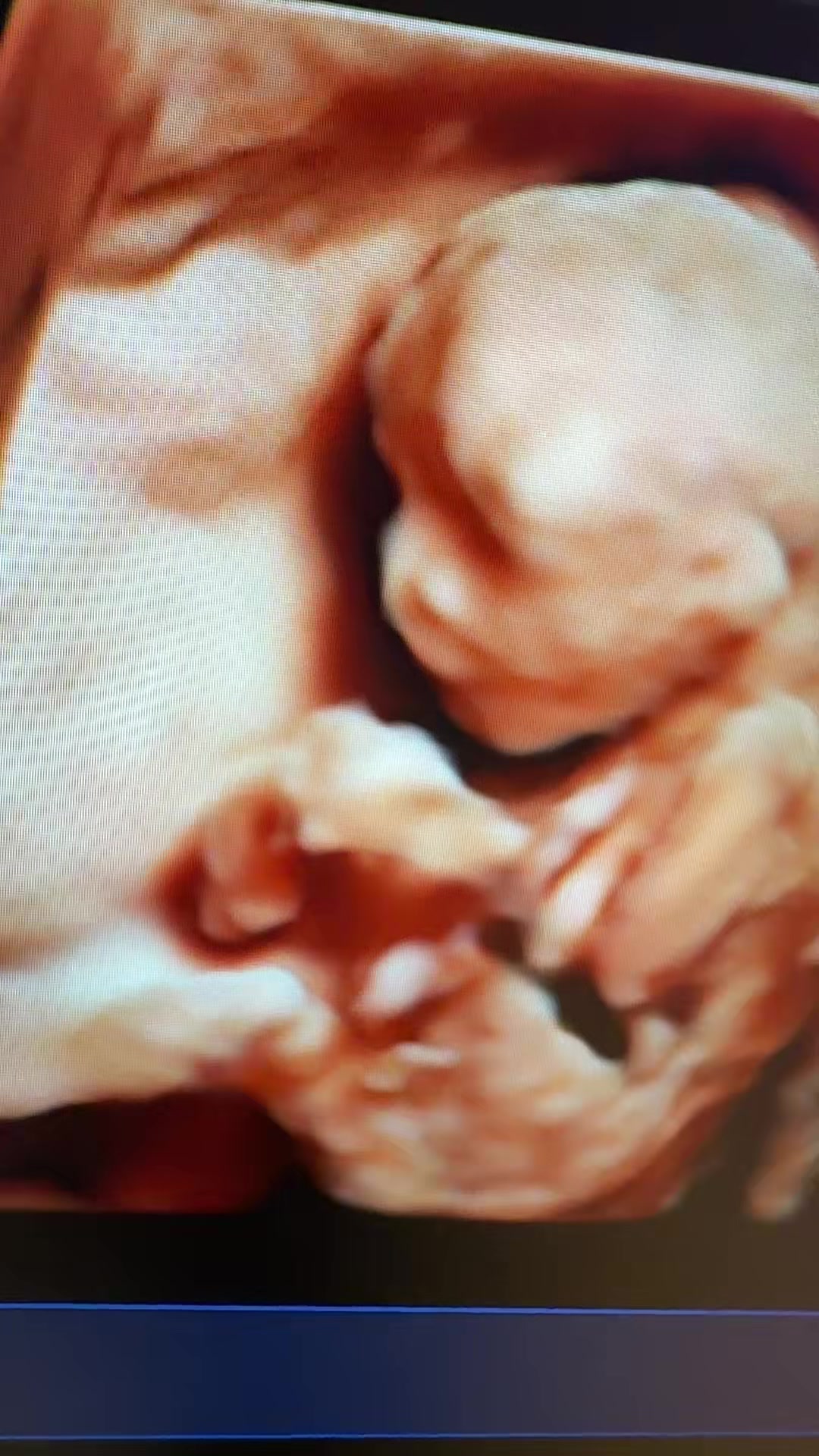 @PregnantSee Inc.