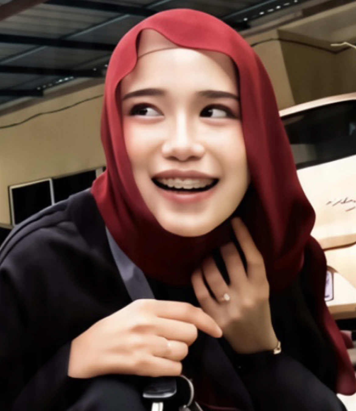 @๐๐ป๐ฝ๐ผ๐ผ๐ เฑจเง