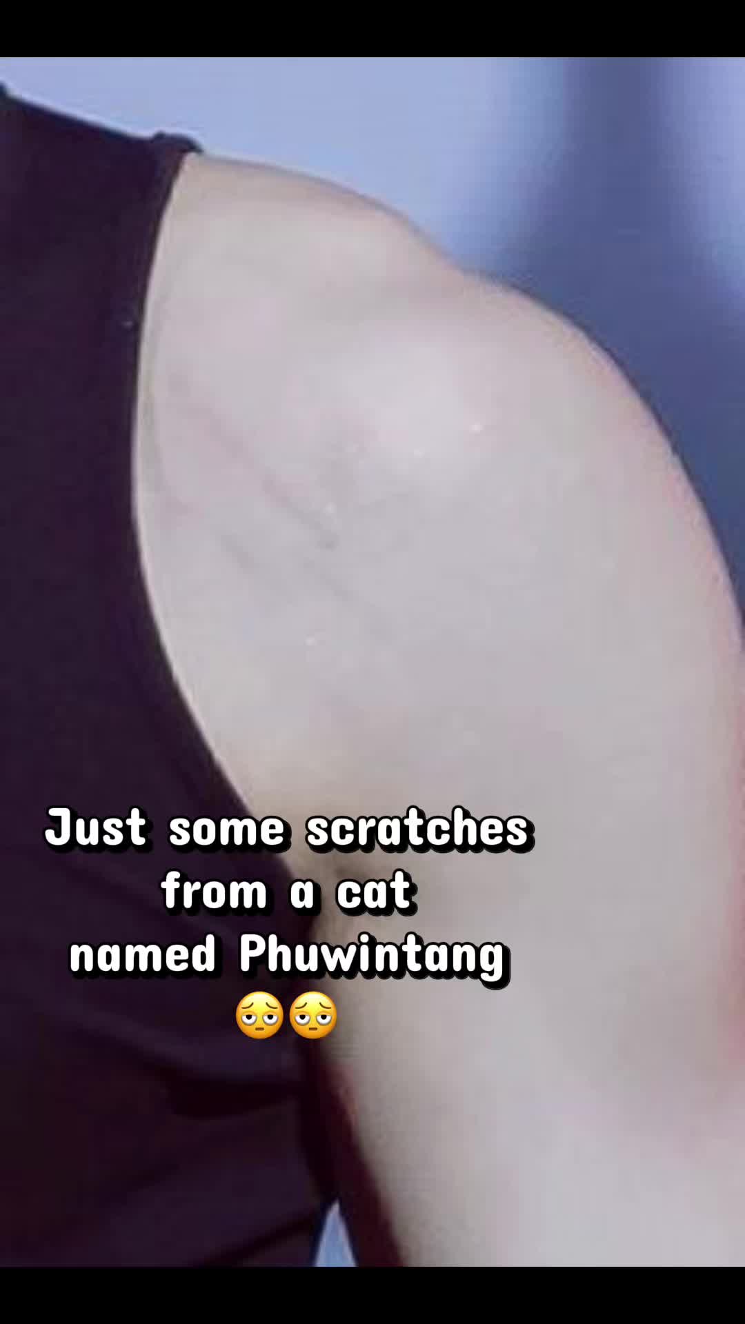 @PP