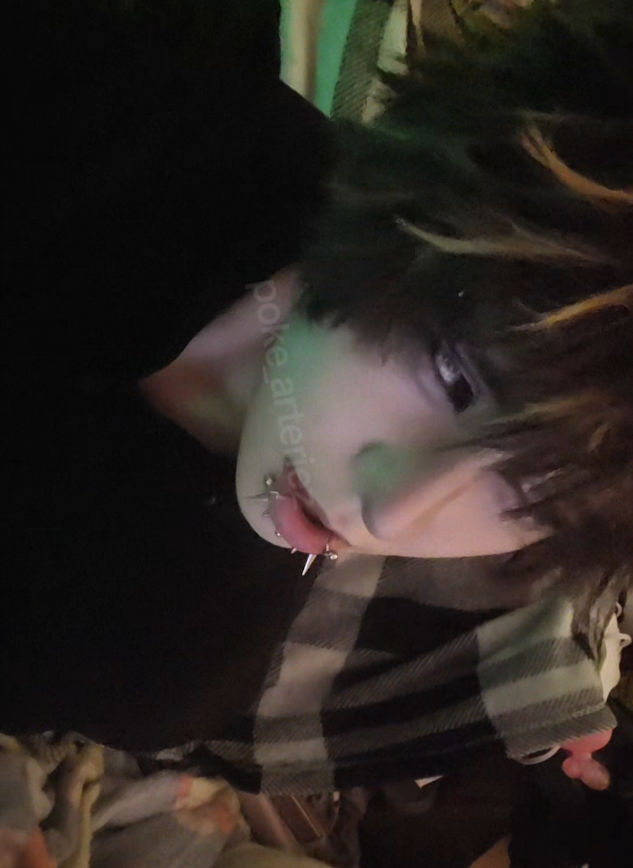@Arteriez.