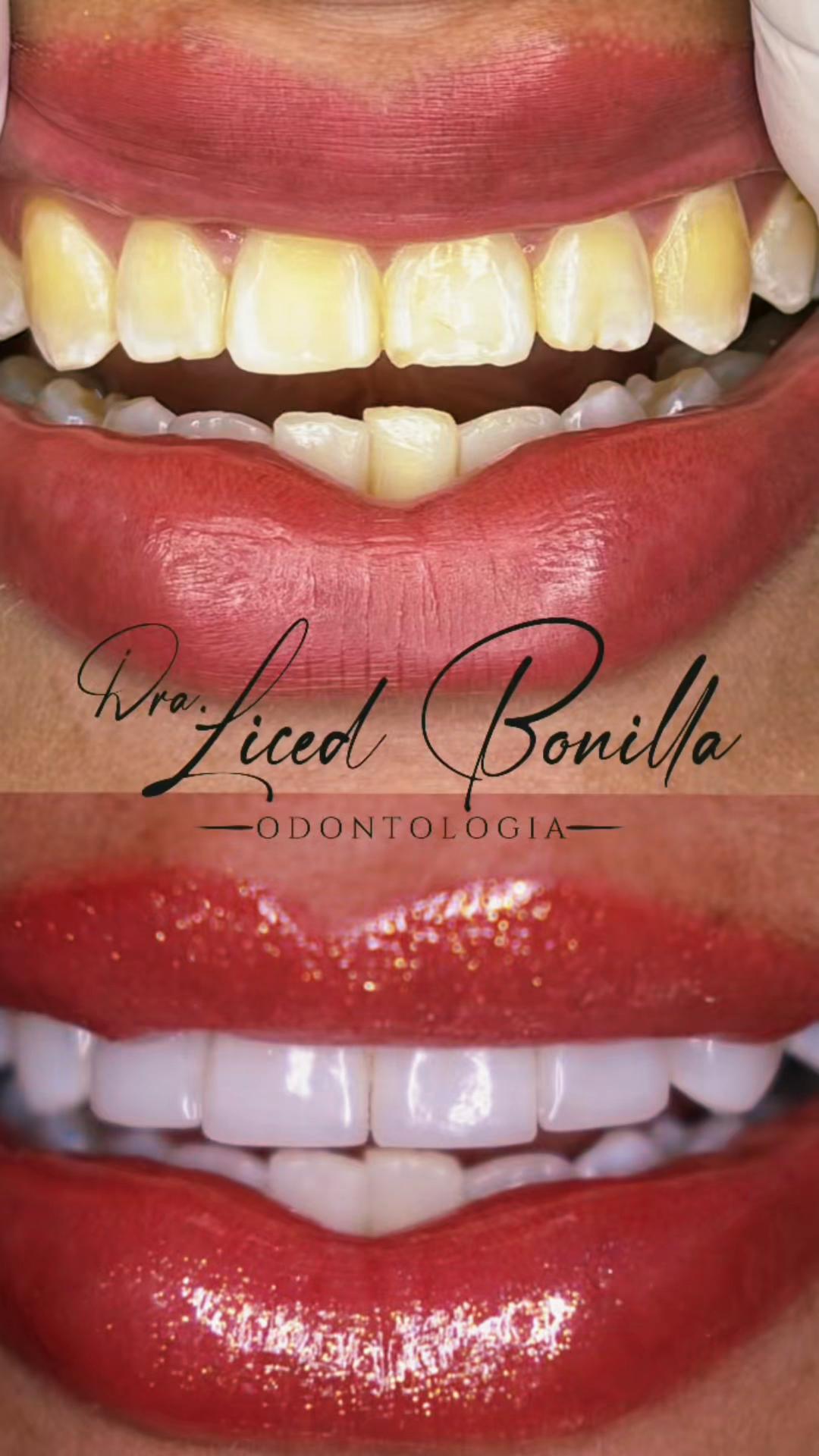 @Dralizbonilla