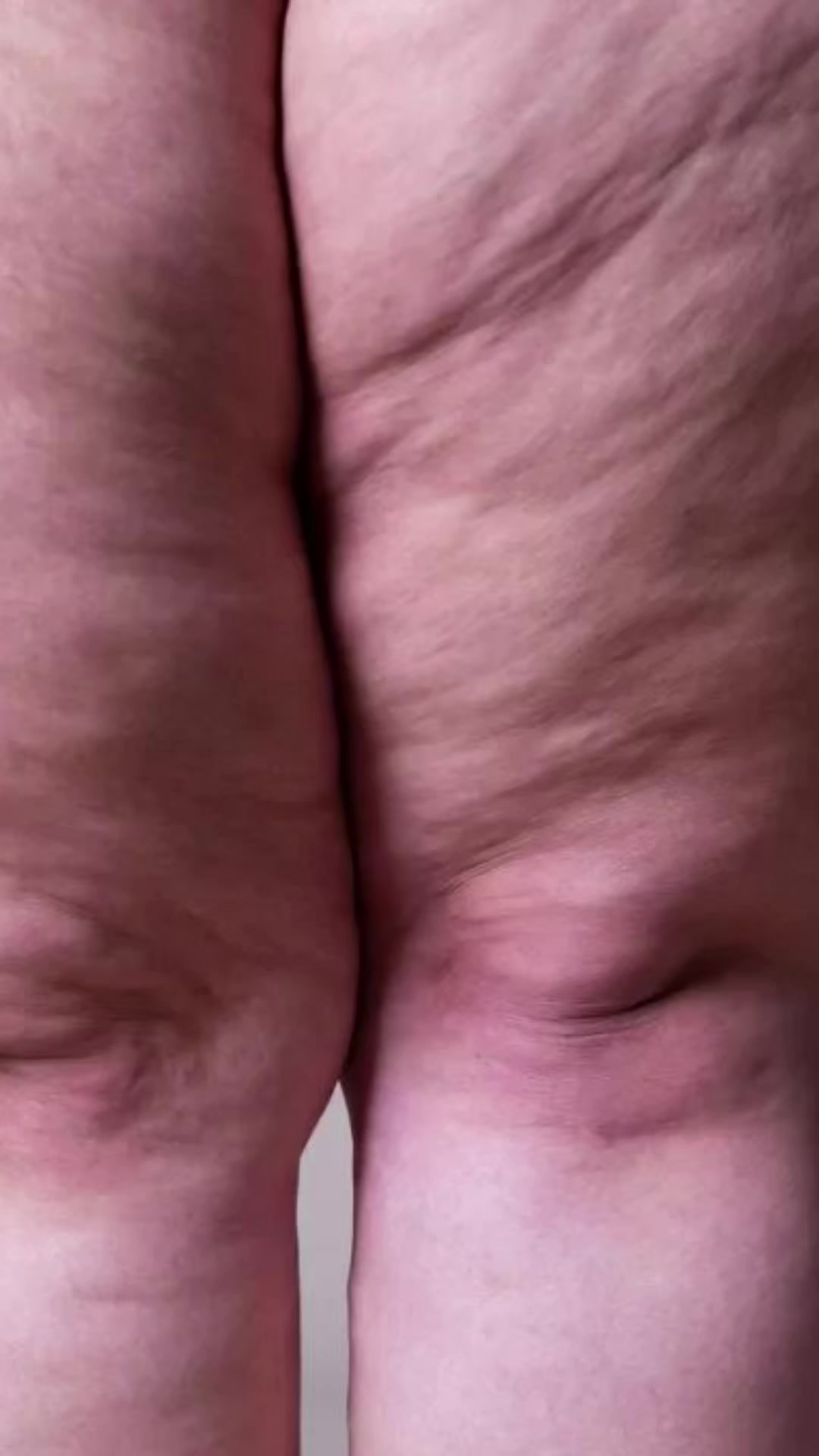 @Dermat&oacute;loga Cindy Burbano