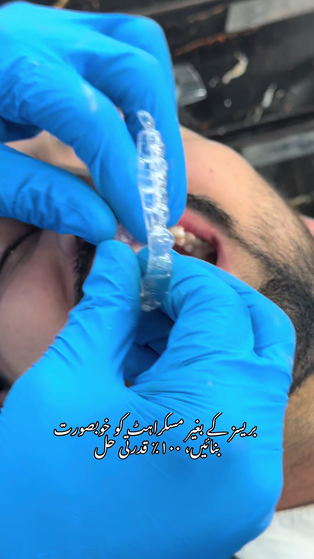 @Dr- syed numan official✅✅