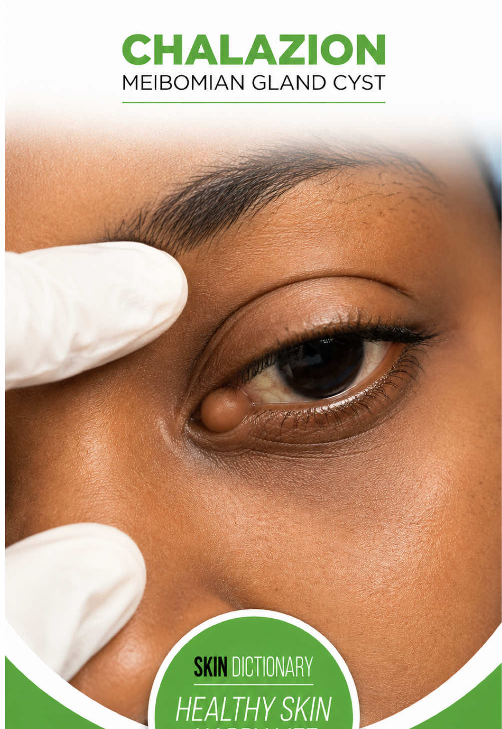 @Skin Dictionary
