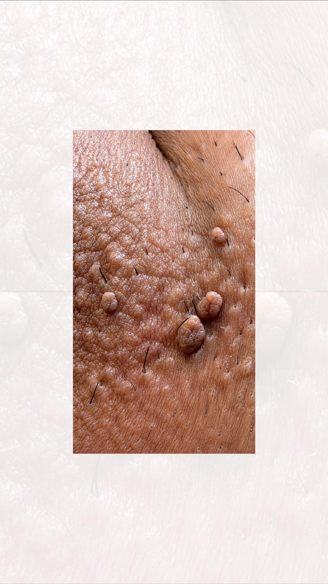 @Skin Dictionary