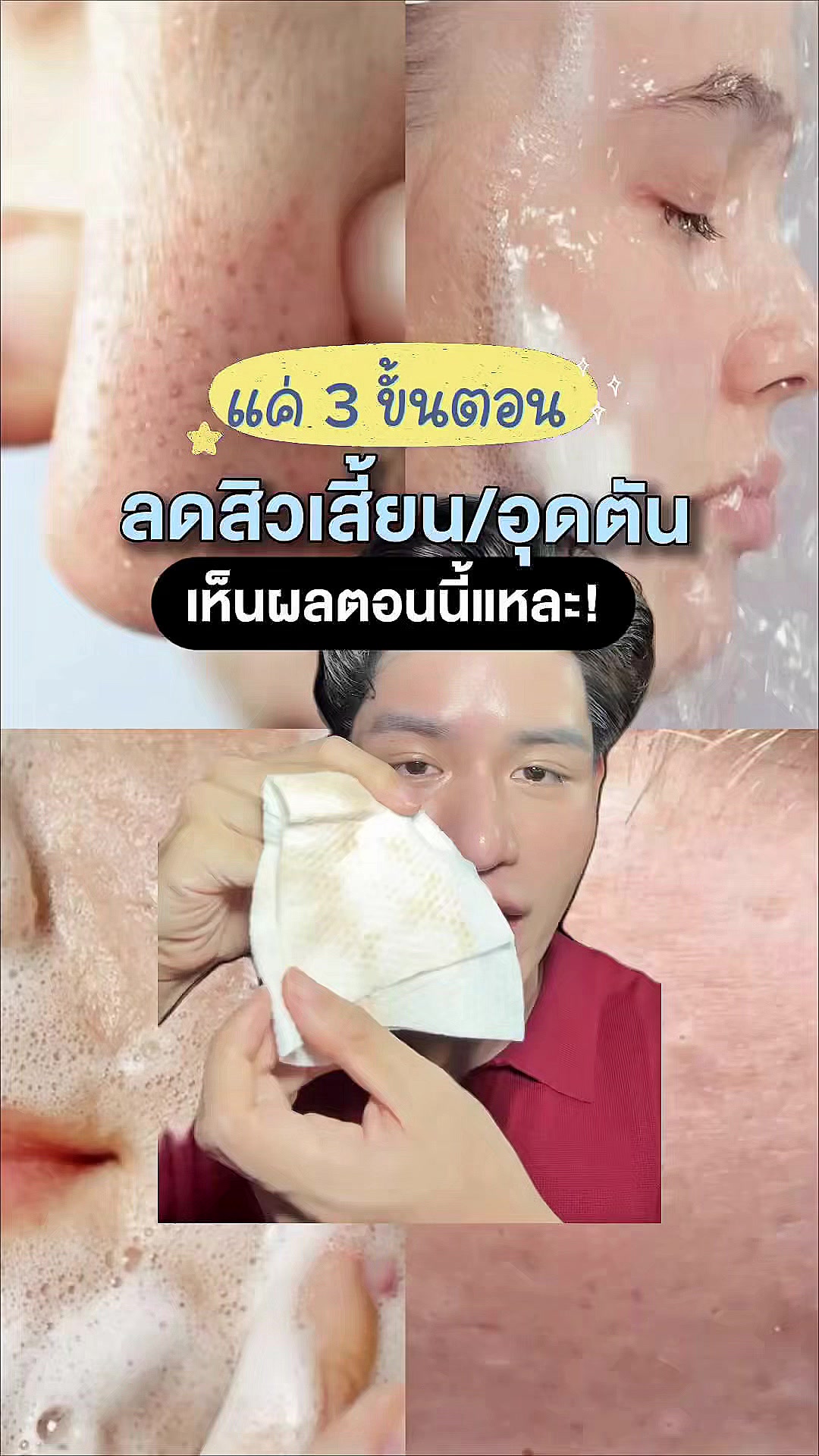 @หนูปอนด์ที่ชอบเลเซ่อร์