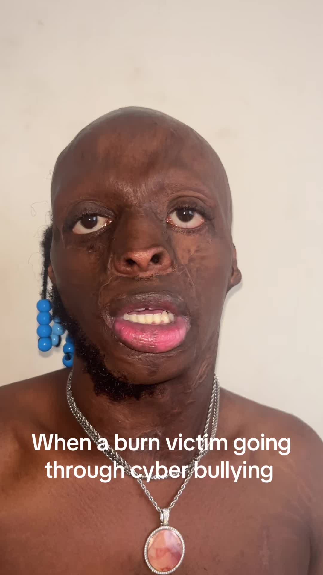@burntfolks00