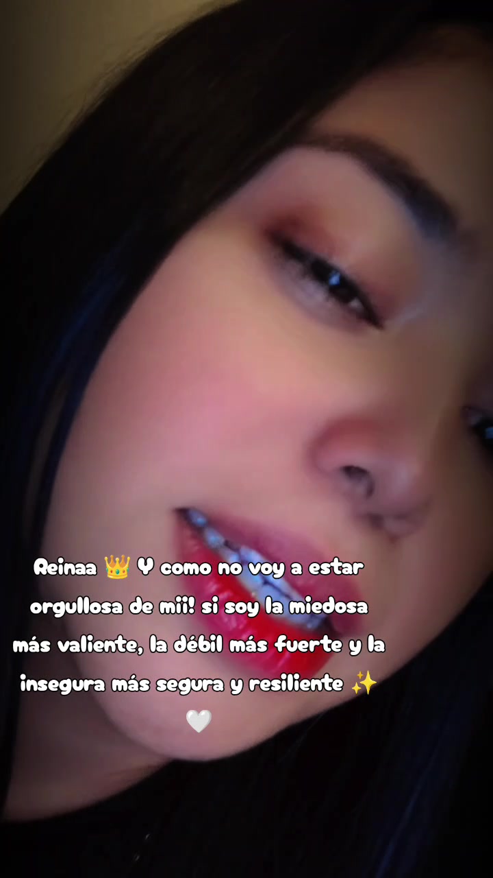 @💜Yaky Turcios 👑💜
