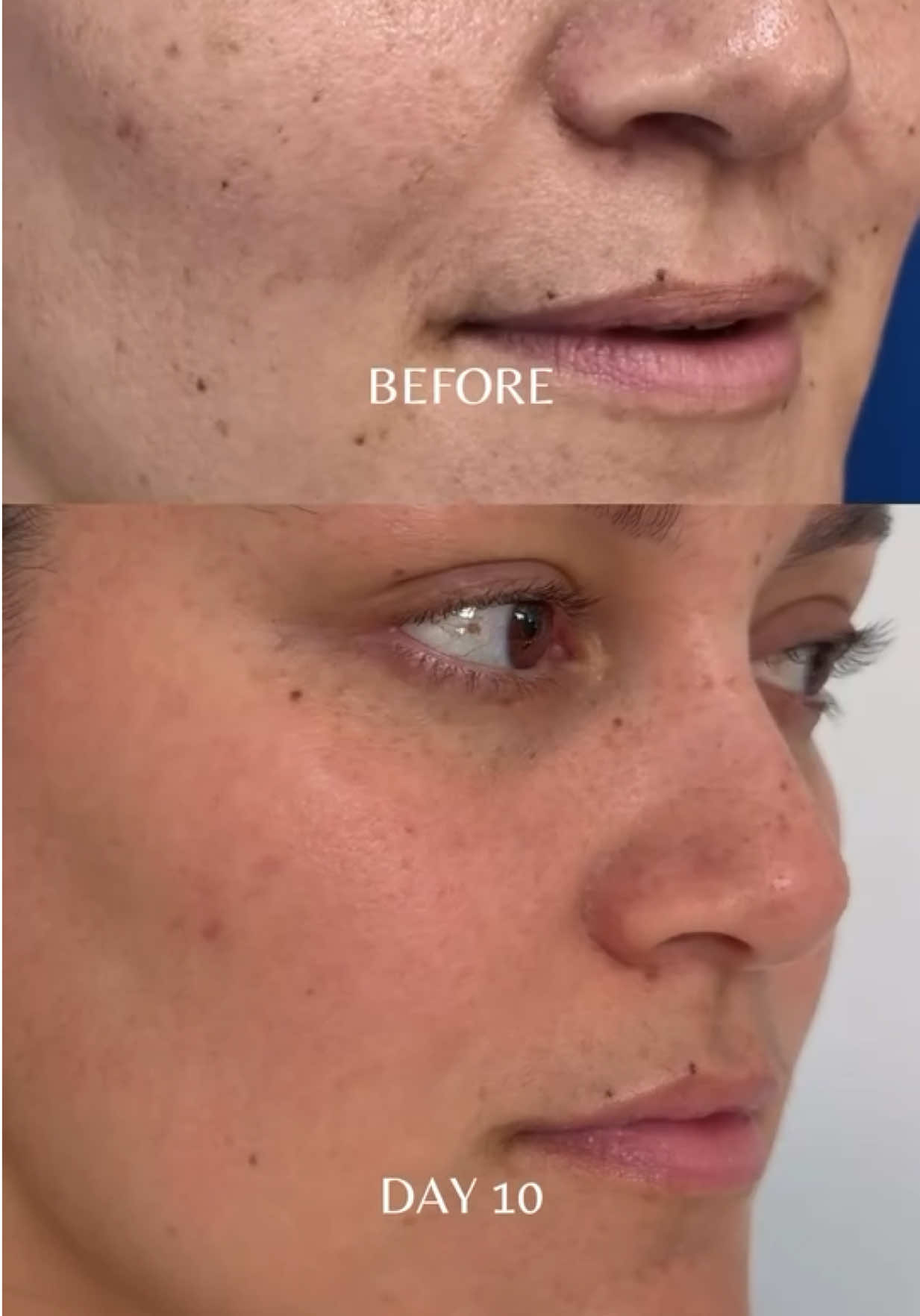 @Cohen MD Plastic Surgery