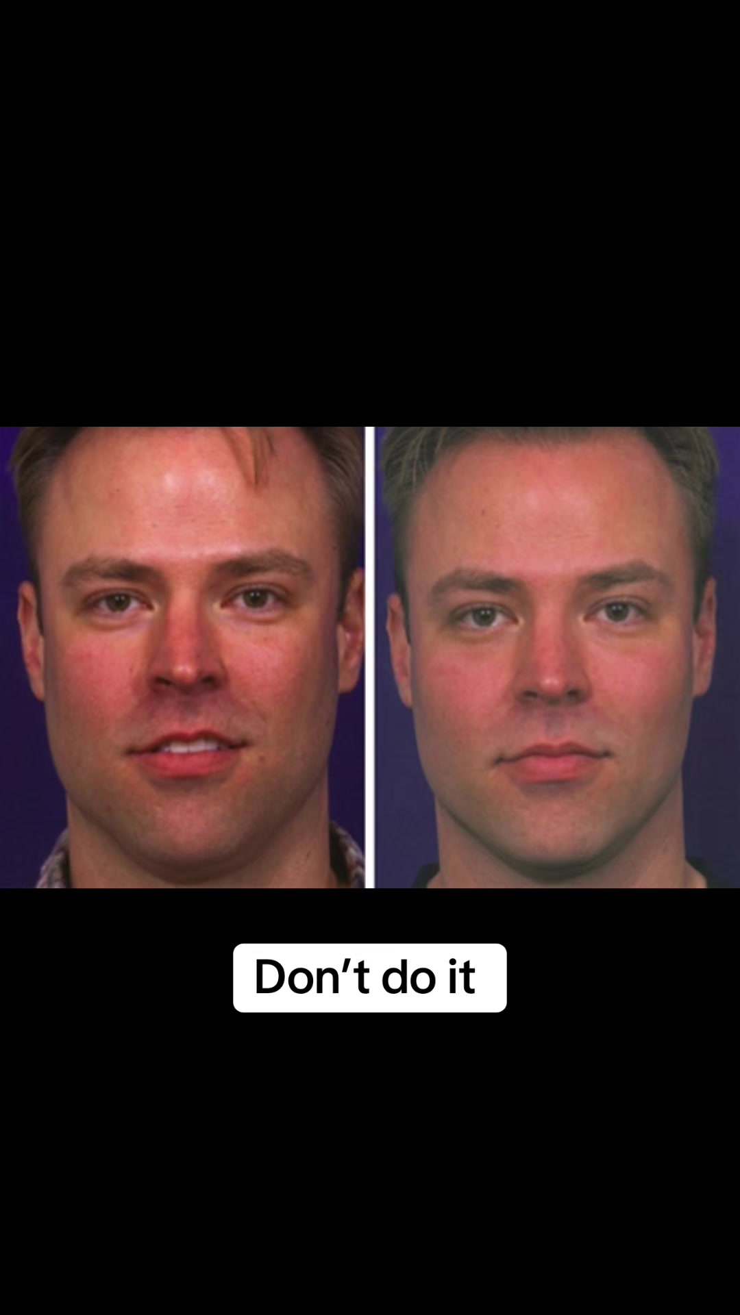 @FaceMetrics