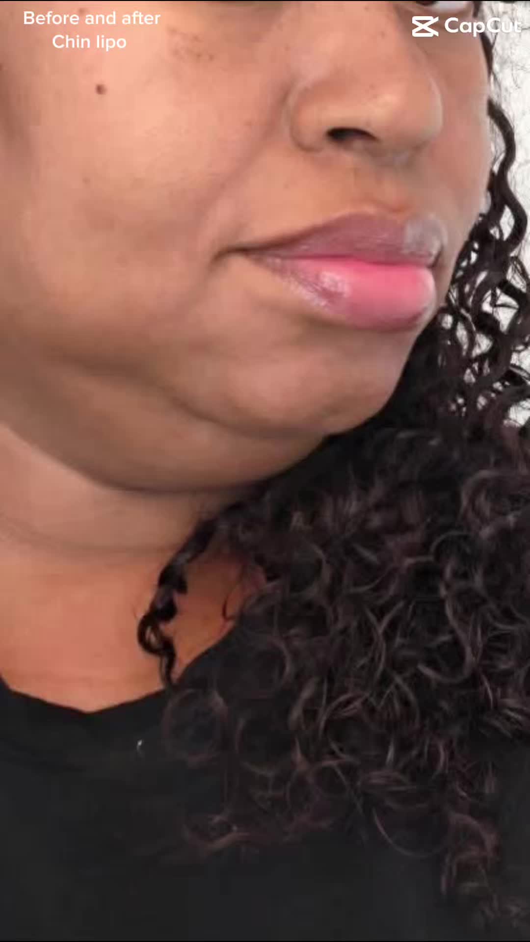 @BioAesthetic305
