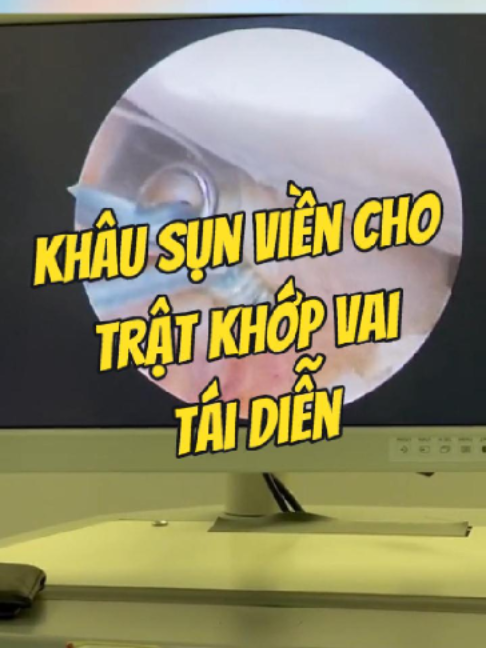 @Chuyên gia xương khớp