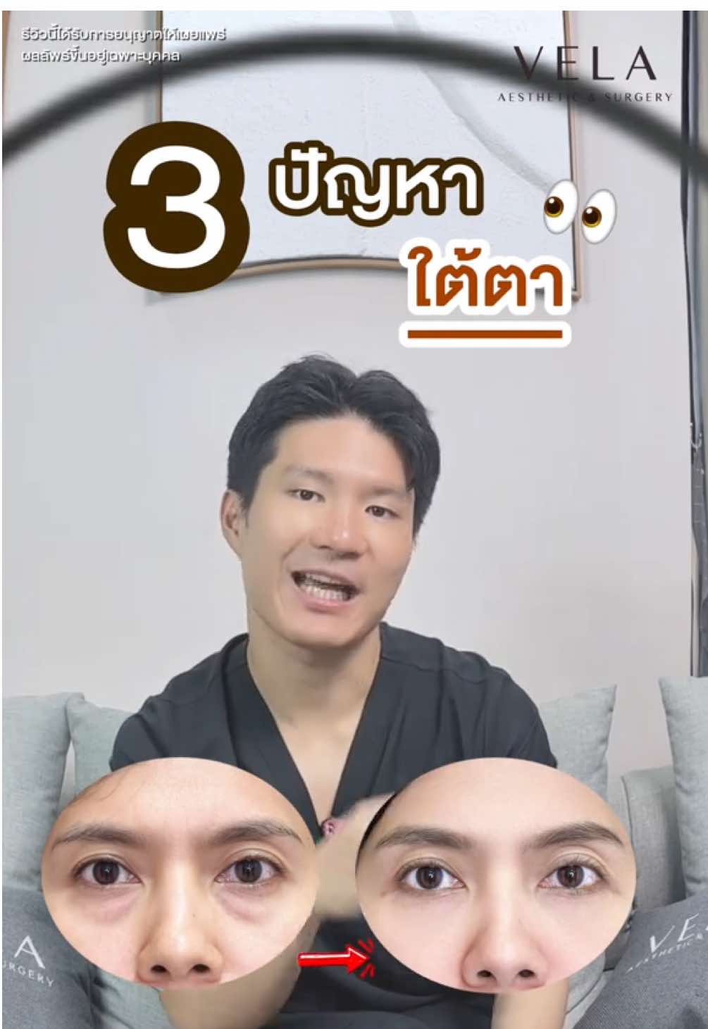 @เวลาคลินิก ตาสองชั้น ถุงใต้ตา