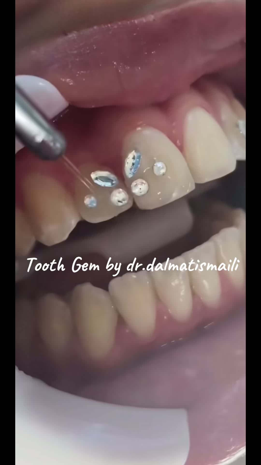 @Dr. Dalmat Ismaili